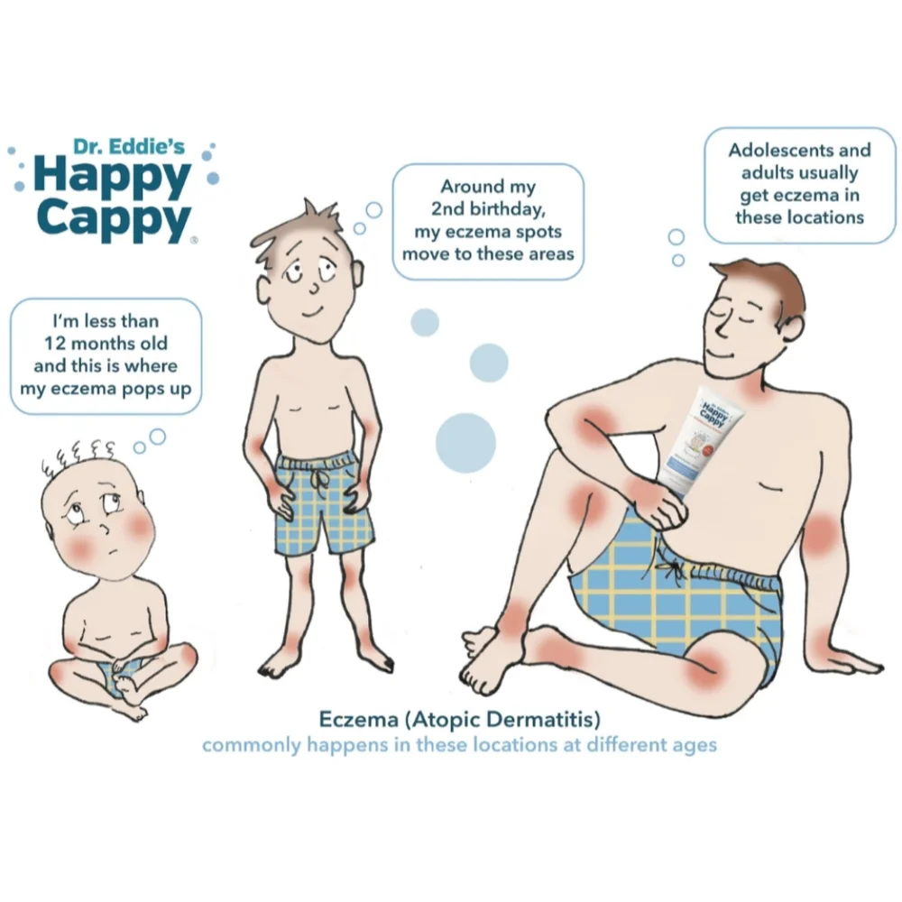 Happy Cappy Baby Skin & Hair Eczema Shampoo Body Wash Soap Cream Lotion Gift Set